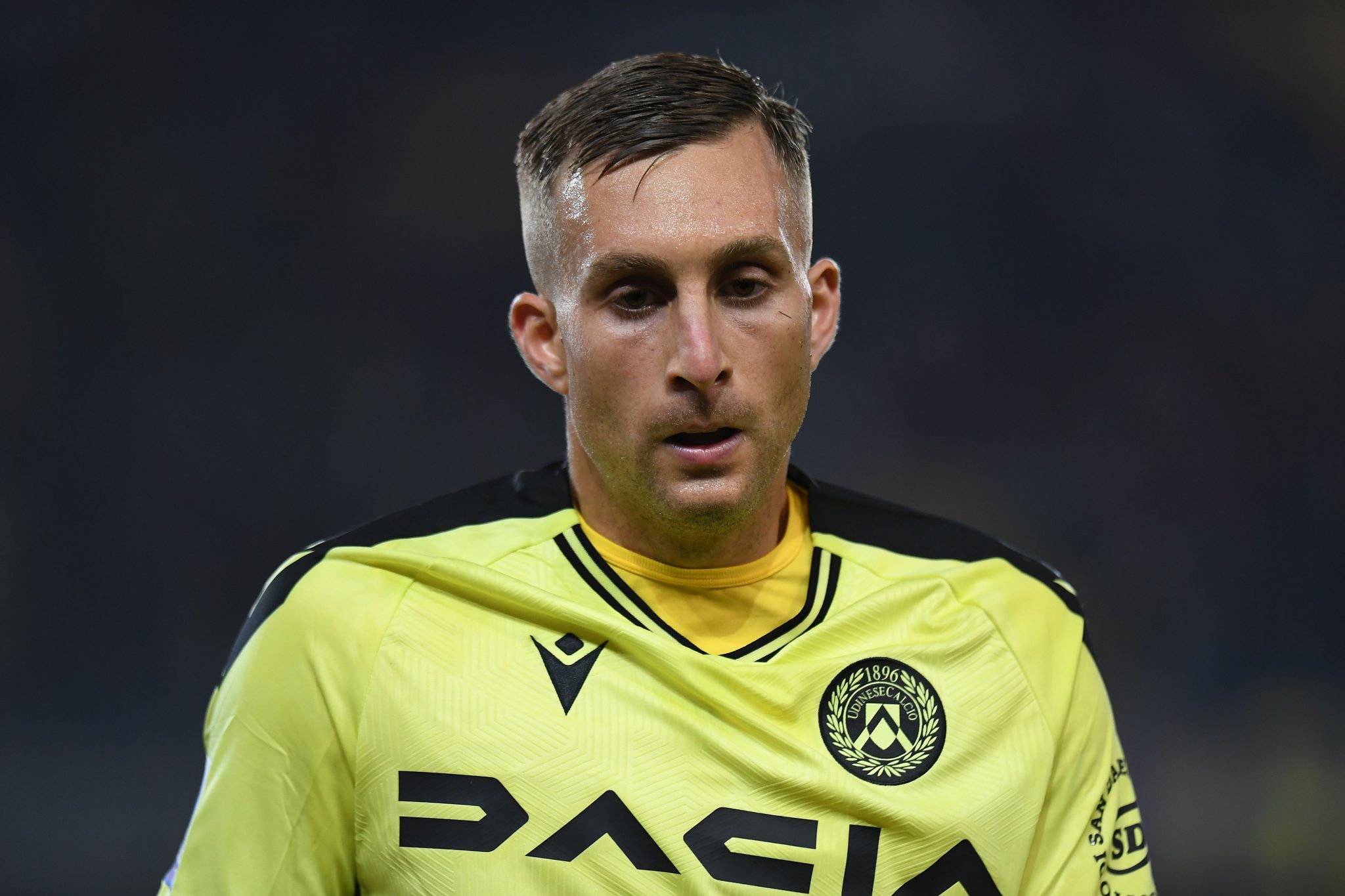 deulofeu vuole tornare una persona normale avrebbe bisogno di una protesi ma non mi arrendo da Mondoudinese.it deulofeu vuole tornare una persona normale avrebbe bisogno di una protesi ma non mi arrendo